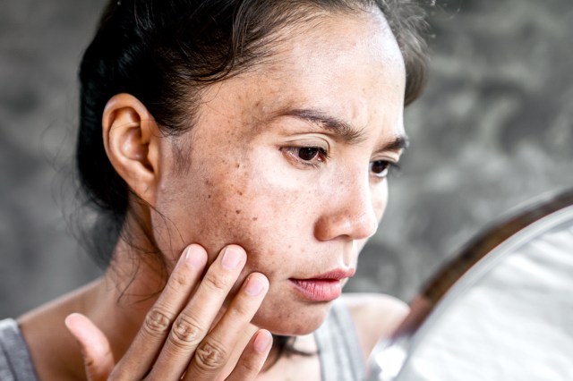 Woman looking at her face, dark spots in a mirror