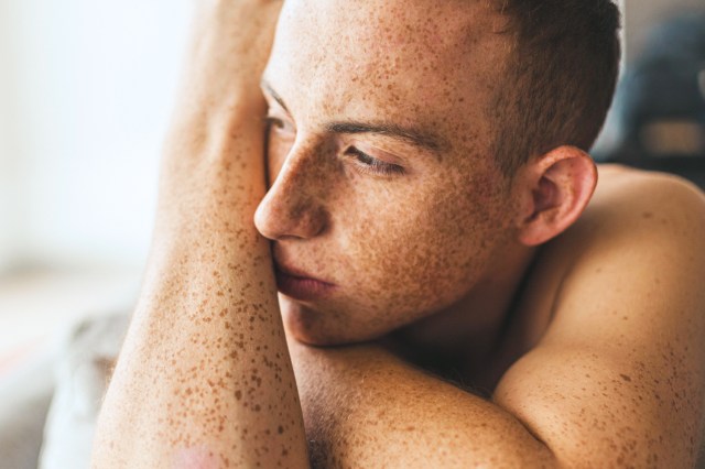 Shirtless man with lots of freckles resting on his arm