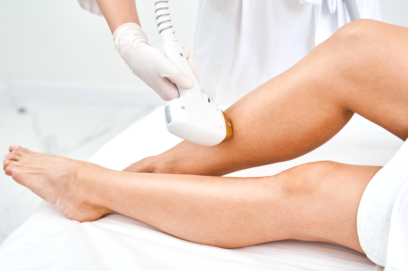 Laser hair removal treatment