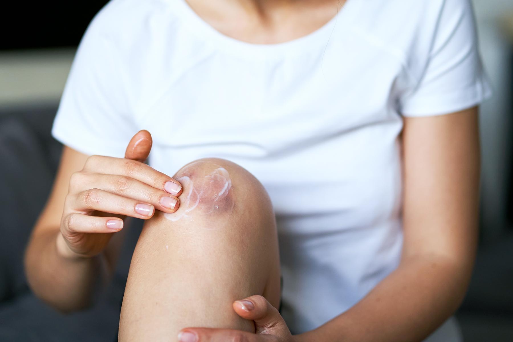 person pointing ointment on their knee