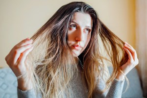 woman with greasy hair